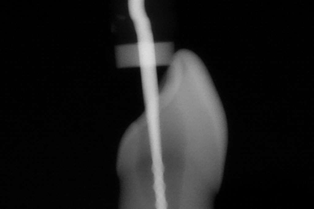 Endodoncie